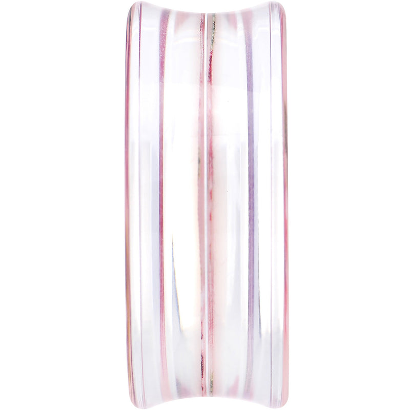 36mm Acrylic Pink Grandma's Wallpaper Flowered Saddle Plug