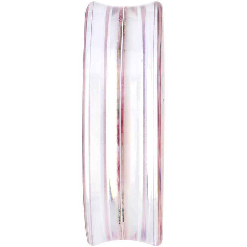 44mm Acrylic Pink Grandma's Wallpaper Flowered Saddle Plug
